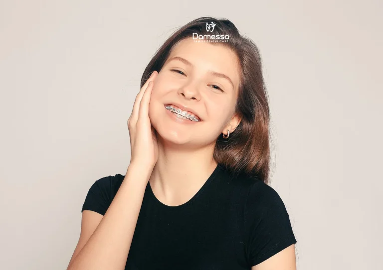 gummy smile
