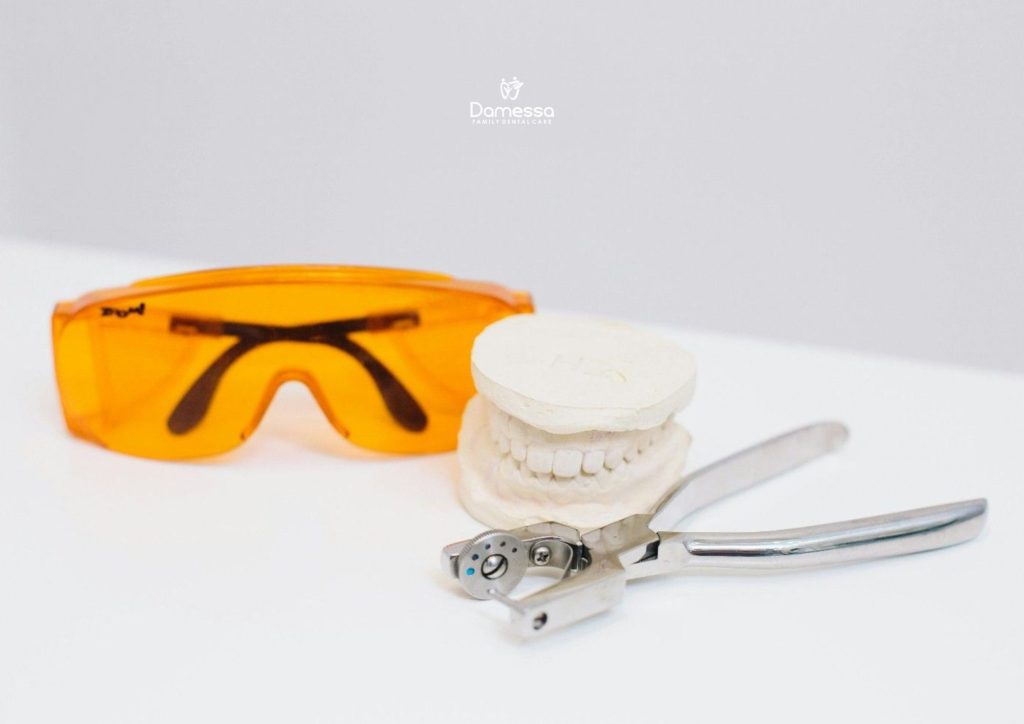 Infeksi Setelah Cabut Gigi