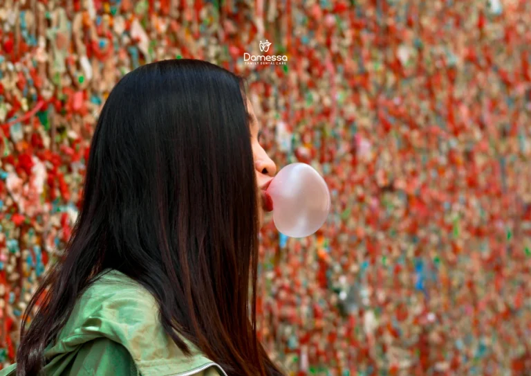 Daftar Pantangan Makanan Sakit Gigi Berlubang