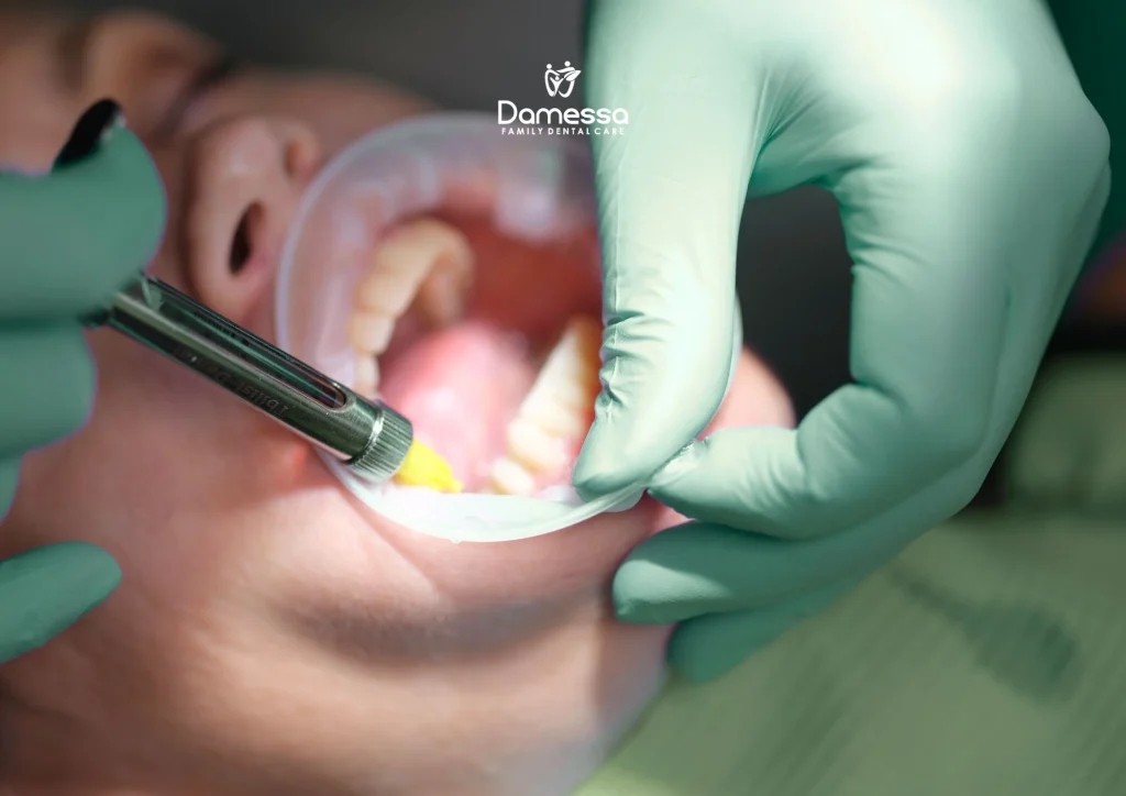 Cara merapikan gigi dengan tangan