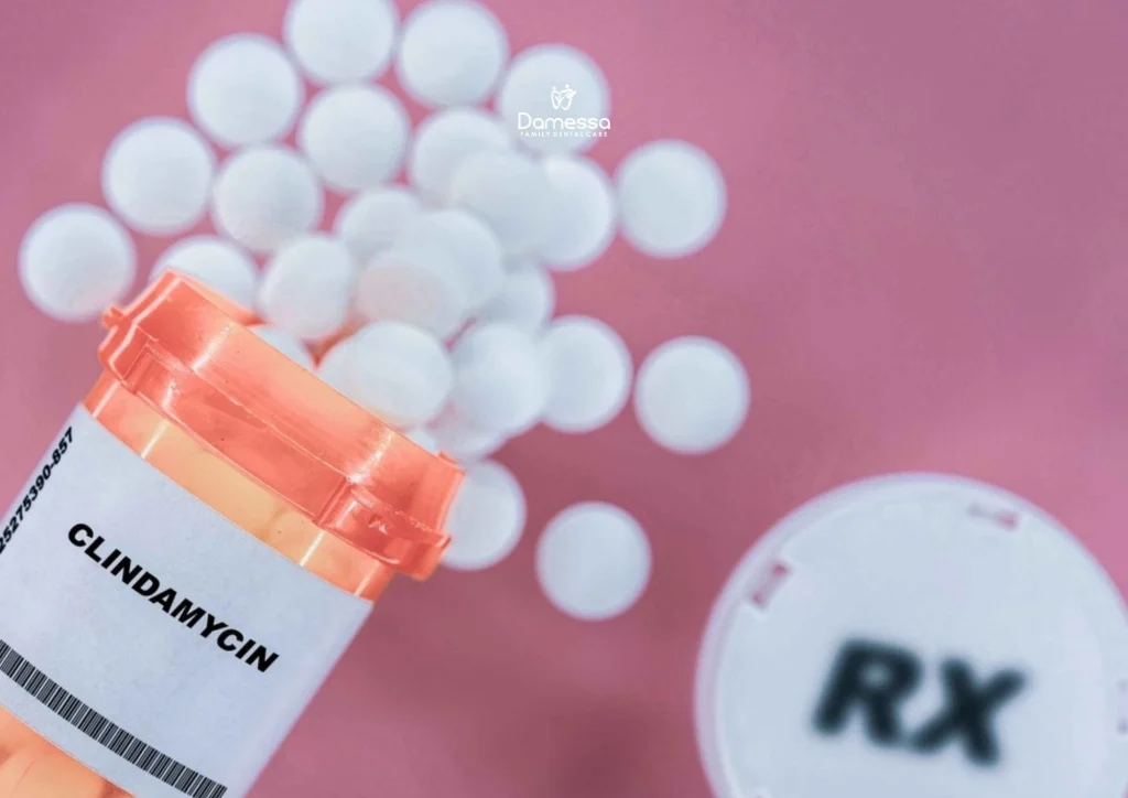 Clindamycin hcl 300 mg untuk sakit gigi