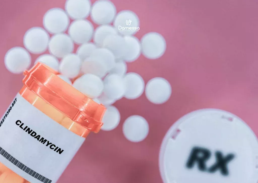 Clindamycin hcl 300 mg untuk sakit gigi