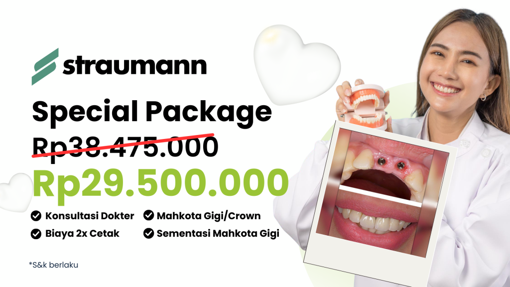 Implant Gigi Straumann