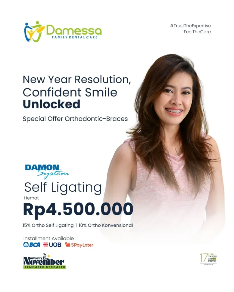 ORTHO DAMON LIGATING