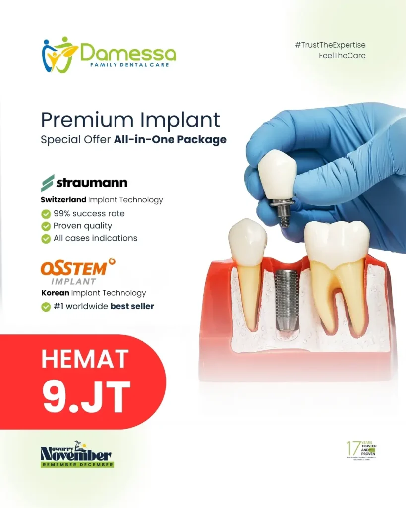 PREMIUM IMPLANT
