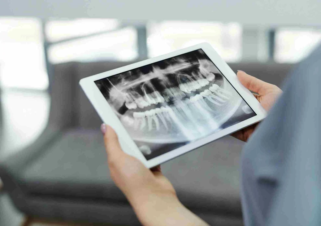 Preventive Resin Restoration