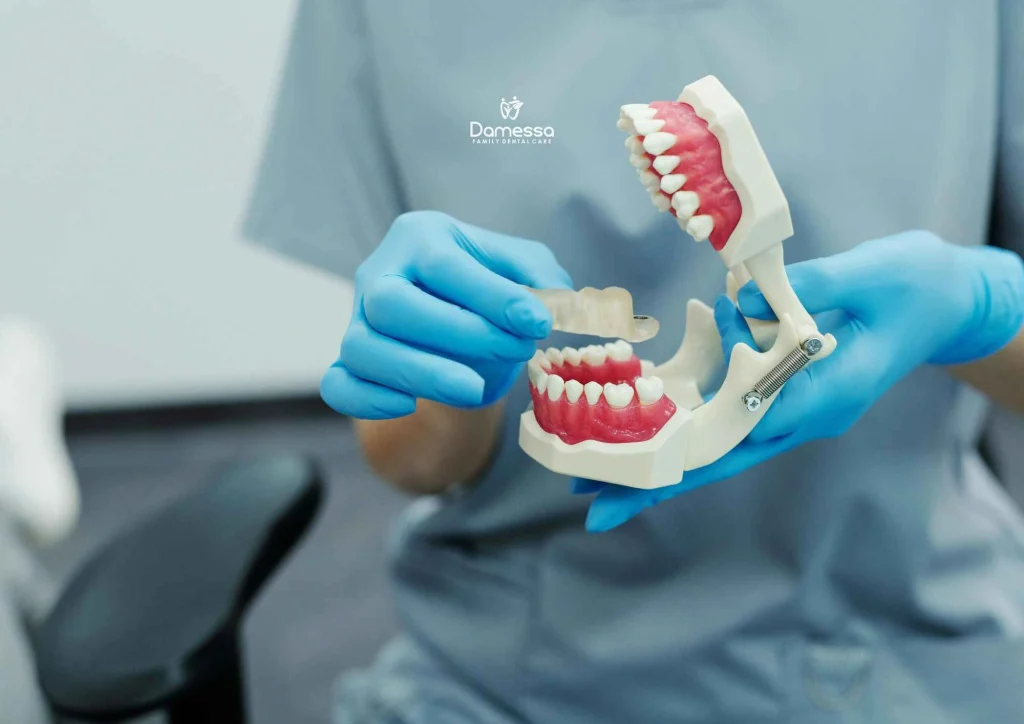 harga tambal gigi di puskesmas