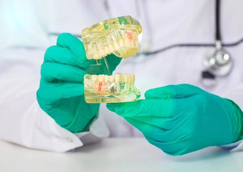 Harga Gigi Palsu Permanen