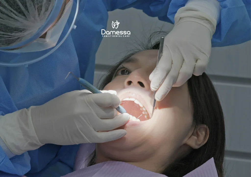 Gusi Hitam di Sekitar Implan