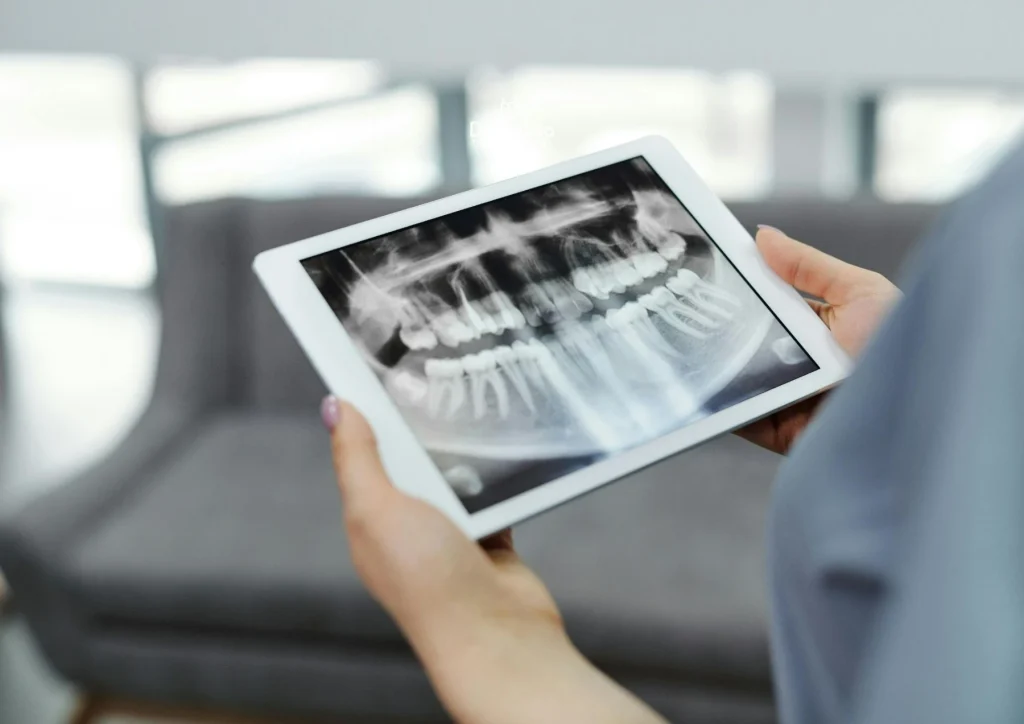 Harga Gigi Palsu untuk Ompong Semua