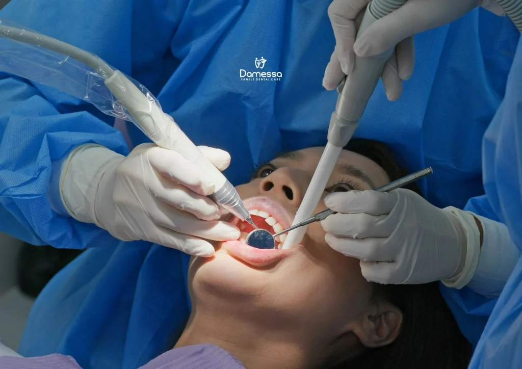 Karang Gigi dan Penyakit Jantung