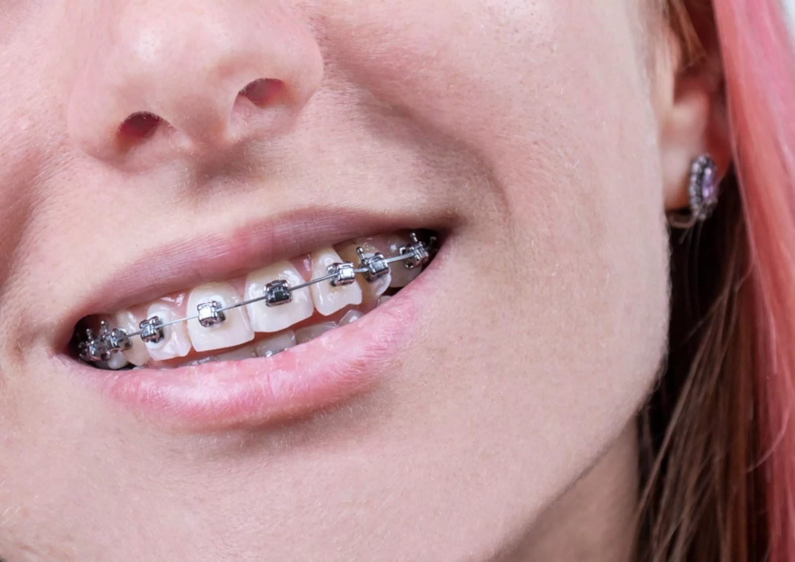 WhatsApp Image 2026 03 10 at 16.32.05 WhatsApp Image 2026 03 10 at 16.32.05