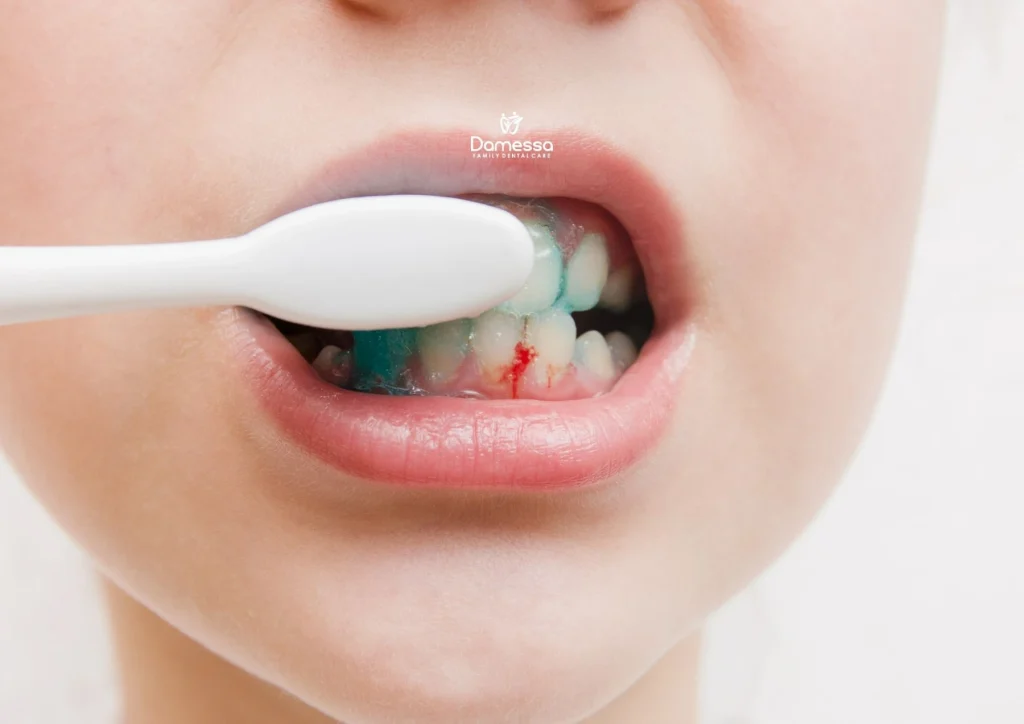 Pasta Gigi untuk Perokok Pasta Gigi untuk Perokok