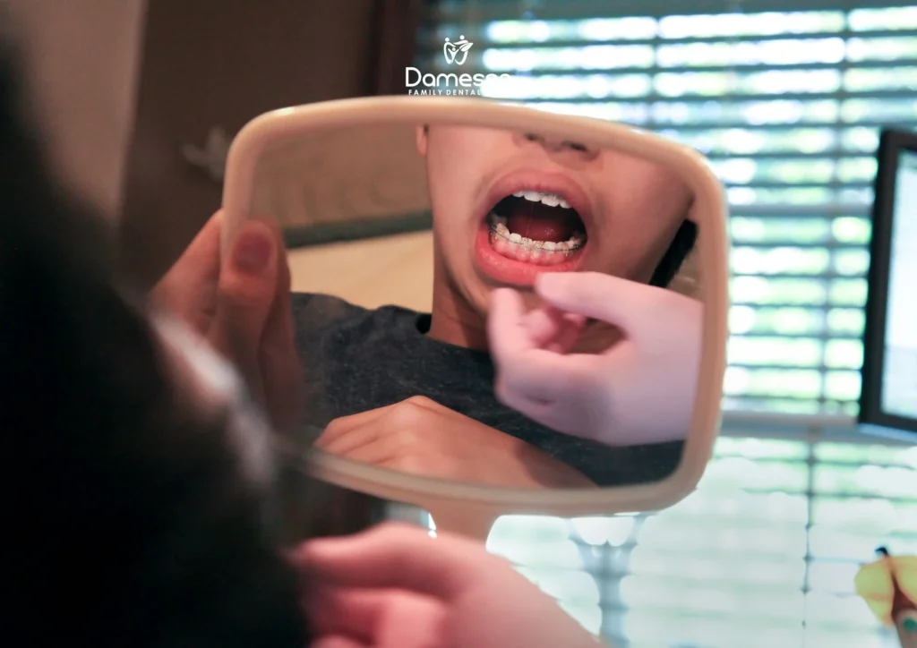 Menjilat Bibir