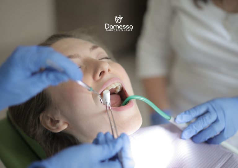 Biaya Operasi Odontektomi Gigi Bungsu