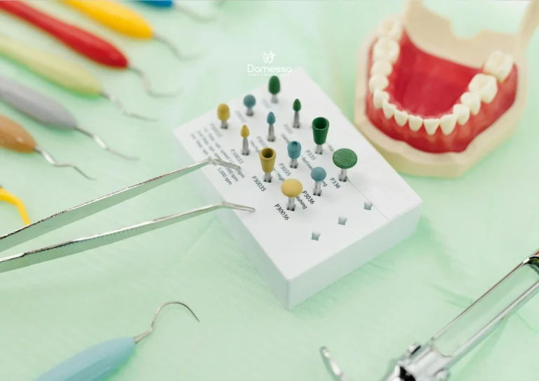 Bone Graft Gigi