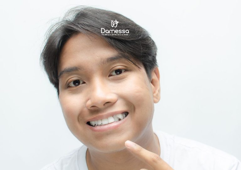 5 Hal yang Perlu Diketahui Sebelum Pasang Behel Gigi Gingsul